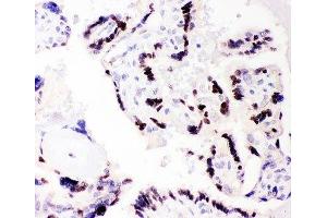 IHC-P: C/EBP beta antibody testing of human placenta tissue (CEBPB Antikörper  (AA 1-200))