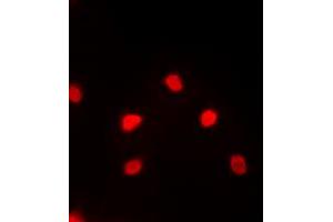 Immunofluorescent analysis of MEF2C staining in PC12 cells. (MEF2C Antikörper  (C-Term))