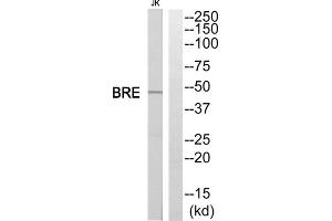 Western blot analysis of extracts from Jurkat cells, using BRE antibody. (BRE Antikörper  (C-Term))