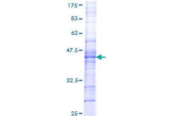 CHRM5 Protein (AA 281-390) (GST tag)