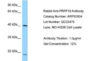 Western Blotting (WB) image for anti-PRP18 Pre-mRNA Processing Factor 18 (PRPF18) (N-Term) antibody (ABIN2789288) (PRPF18 Antikörper  (N-Term))