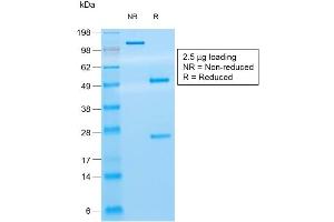 SDS-PAGE Analysis of Purified CD8a Mouse Recombinant Monoclonal Antibody ABIN6383871. (Rekombinanter CD8 alpha Antikörper)