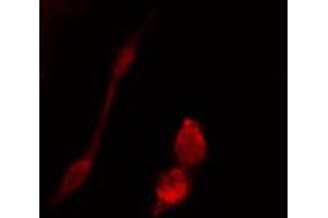 ABIN6274442 staining 293 cells by IF/ICC. (BRSK1 Antikörper  (Internal Region))