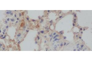 Immunohistochemistry of paraffin-embedded Rat lung using Aβ40 Polyclonal Antibody at dilution of 1:50 (Abeta 1-40 Antikörper)