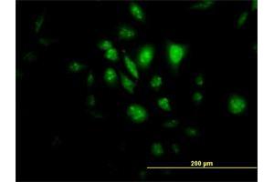 Immunofluorescence of monoclonal antibody to STK33 on HeLa cell. (STK33 Antikörper  (AA 1-514))