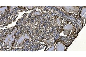 IHC analysis of MIEF1 using anti-MIEF1 antibody (ABIN7600396). (SMCR7L Antikörper  (AA 189-463))
