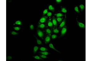 Immunofluorescence staining of A549 cells with ABIN7161832 at 1:100, counter-stained with DAPI. (NUP98 Antikörper  (AA 965-1110))