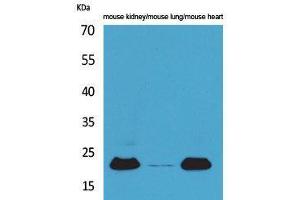 Western Blotting (WB) image for anti-Adrenomedullin (ADM) (Internal Region) antibody (ABIN3178233) (Adrenomedullin Antikörper  (Internal Region))