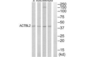 Western Blotting (WB) image for anti-Actin, beta-Like 2 (ACTBL2) (Internal Region) antibody (ABIN1852742) (ACTBL2 Antikörper  (Internal Region))