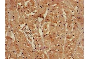 Immunohistochemistry of paraffin-embedded human heart tissue using ABIN7152346 at dilution of 1:100 (SULF2 Antikörper  (AA 463-660))
