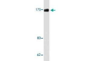 Western blot analysis of LoVo cell lysate with TOP2A polyclonal antibody . (Topoisomerase II alpha Antikörper)