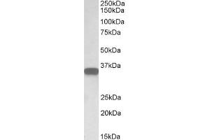 ABIN570905 (0. (CD20 Antikörper  (C-Term))