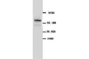 Western blot analysis of rat pancreas tissue lysis using GLAST antibody (SLC1A3 Antikörper  (C-Term))