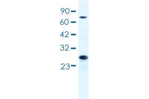 Western blot analysis of HepG2 cell lysate with MCM6 polyclonal antibody . (MCM6 Antikörper  (AA 771-820))