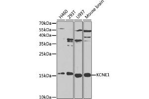 Western Blotting (WB) image for anti-Potassium Voltage-Gated Channel, Isk-Related Family, Member 1 (KCNE1) (AA 1-100) antibody (ABIN3021635)