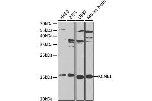 Western blot analysis of extracts of various cell lines, using KCNE1 antibody (ABIN3021634, ABIN3021635, ABIN3021636, ABIN1513121 and ABIN6215455) at 1:1000 dilution. (KCNE1 Antikörper  (AA 1-100))
