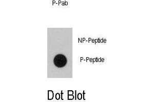 Image no. 1 for anti-B-Raf proto-oncogene, serine/threonine kinase (BRAF) (pThr400) antibody (ABIN358444) (BRAF Antikörper  (pThr400))