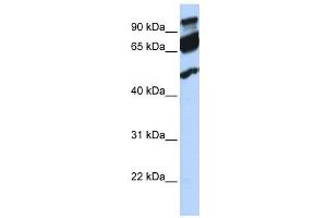 WB Suggested Anti-ERAL1  Antibody Titration: 0. (ERAL1 Antikörper  (Middle Region))