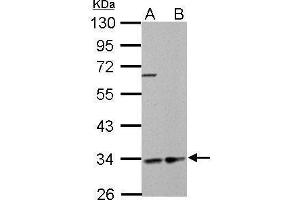 WB Image HADH antibody detects HADH protein by Western blot analysis. (HADH Antikörper)