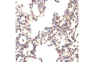 Immunohistochemistry (IHC) image for anti-BCL2-Like 14 (Apoptosis Facilitator) (BCL2L14) antibody (ABIN7265865)