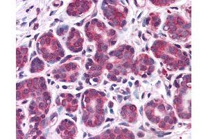 Anti-RBBP8 / CTIP antibody IHC of human breast. (Retinoblastoma Binding Protein 8 Antikörper  (AA 452-747))