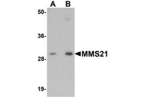 Western blot analysis of MMS21 in 293 cell lysate with MMS21 antibody at (A) 0. (NSMCE2 Antikörper  (C-Term))