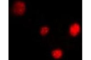 Immunofluorescent analysis of PPAR delta staining in U2OS cells. (PPARD Antikörper)