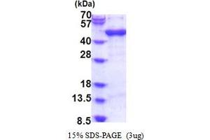 SDS-PAGE (SDS) image for ADP-Ribosylation Factor Interacting Protein 1 (ARFIP1) (AA 1-373) protein (His tag) (ABIN6387486) (ARFIP1 Protein (AA 1-373) (His tag))