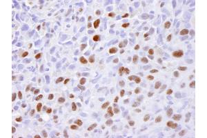 Immunohistochemistry (IHC) image for anti-Minichromosome Maintenance Complex Component 2 (MCM2) (AA 1-50) antibody (ABIN7448987) (MCM2 Antikörper  (AA 1-50))