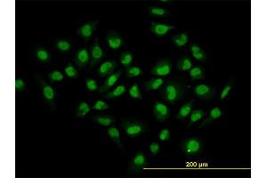 Immunofluorescence of monoclonal antibody to HDAC1 on HeLa cell. (HDAC1 Antikörper  (AA 1-482))