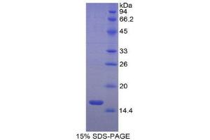 SDS-PAGE (SDS) image for Activin A Receptor, Type IIA (ACVR2A) (AA 20-135) protein (His tag) (ABIN2120461)