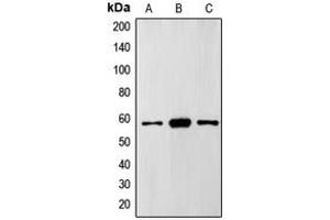 Western blot analysis of FTO expression in HepG2 (A), Caco2 (B), SHSY5Y (C) whole cell lysates.