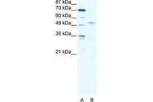 WB Suggested Anti-IRF5 Antibody Titration:  2. (IRF5 Antikörper  (N-Term))