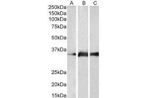 ABIN190841 (2µg/ml) staining of Human Brain (Cerebellum) (A), Mouse Brain (B) and Rat Brain (C) lysates (35µg protein in RIPA buffer). (Kallikrein 5 Antikörper  (Internal Region))