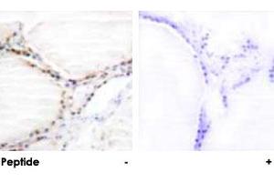 Immunohistochemical analysis of paraffin-embedded human thyroid gland tissue using VDR polyclonal antibody . (Vitamin D Receptor Antikörper  (Ser208))