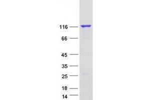 Validation with Western Blot
