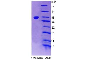 SDS-PAGE (SDS) image for Protein tyrosine Phosphatase, Non-Receptor Type 2 (PTPN2) (AA 1-237) protein (His tag) (ABIN6239491) (PTPN2 Protein (AA 1-237) (His tag))