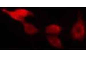 ABIN6266493 staining HeLa cells by IF/ICC. (RAD17 Antikörper  (C-Term))