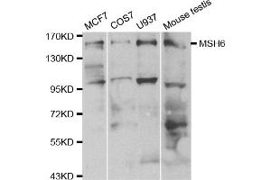 Western blot analysis of extracts of various cell lines, using MSH6 antibody. (MSH6 Antikörper)