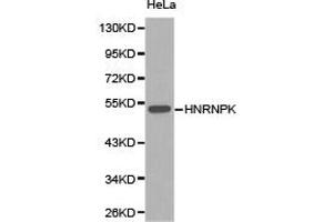 Western Blotting (WB) image for anti-Heterogeneous Nuclear Ribonucleoprotein K (HNRNPK) antibody (ABIN1873067)