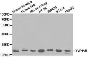Western Blotting (WB) image for anti-14-3-3 alpha + beta (YWHAB) antibody (ABIN1875376) (YWHAB Antikörper)