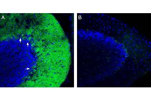 Expression of ZIP14 in mouse cerebellum.
