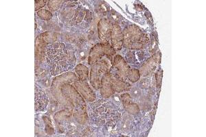 Immunohistochemical staining (Formalin-fixed paraffin-embedded sections) of human kidney with SAV1 polyclonal antibody  shows strong cytoplasmic positivity in renal tubules. (SAV1 Antikörper)