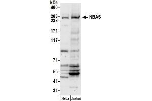 anti-Neuroblastoma Amplified Sequence (NBAS) (AA 350-400) antibody