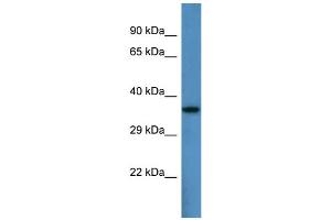 Host:  Rabbit  Target Name:  Pard6b  Sample Type:  Mouse Heart lysates  Antibody Dilution:  1. (PARD6B Antikörper  (N-Term))