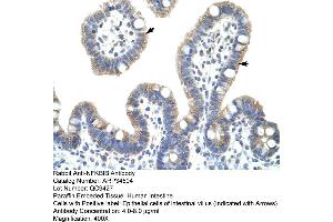 Human Intestine (NFKBIB Antikörper  (C-Term))