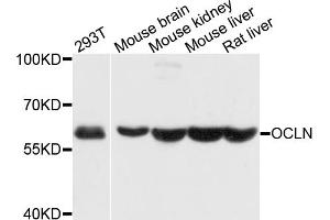 Western blot analysis of extracts of various cell lines, using OCLN antibody (ABIN4904607) at 1:1000 dilution. (Occludin Antikörper)