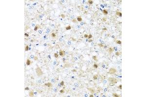 Immunohistochemistry of paraffin-embedded rat brain using ZBTB17 antibody (ABIN6133380, ABIN6150370, ABIN6150371 and ABIN6224531) at dilution of 1:100 (40x lens). (ZBTB17 Antikörper  (AA 121-360))