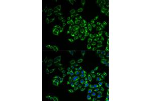 Immunofluorescence analysis of MCF-7 cell using FIS1 antibody. (Fission 1 Antikörper)