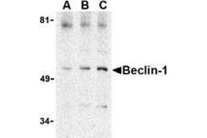 AP20057PU-N Beclin-1 antibody staining of A431 cell lysate by Western Blotting at (A) 0.